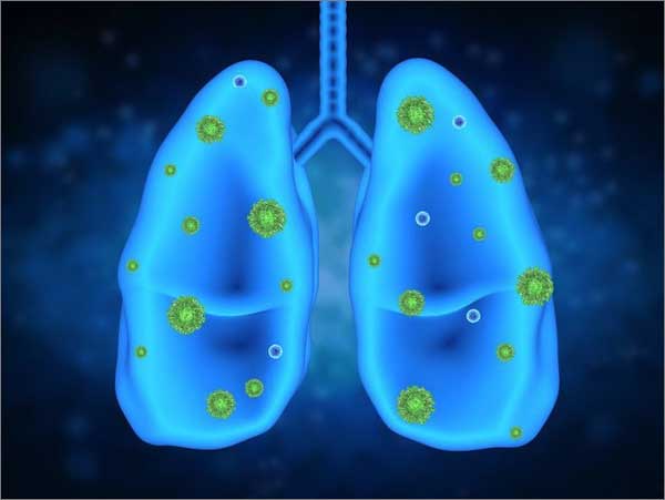 lung_copd